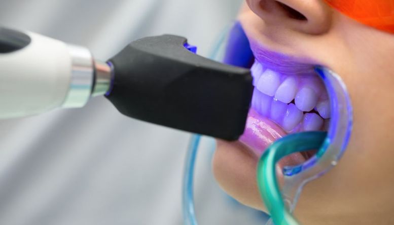 Eating with Braces: Friendly Foods for a Healthy Smile