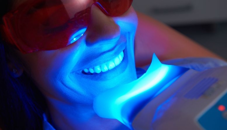 5 Effective Tips for Maintaining White Teeth After Cosmetic Whitening