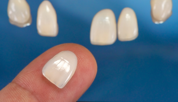 Eating with Braces: Friendly Foods for a Healthy Smile