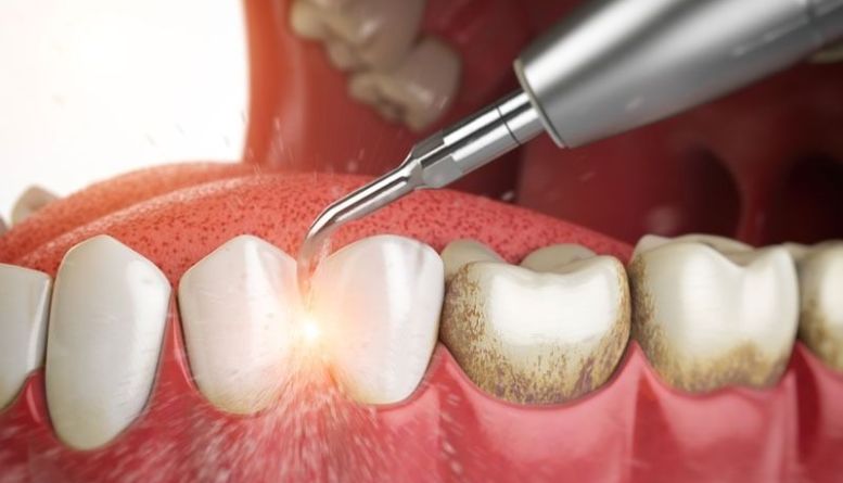 Eating with Braces: Friendly Foods for a Healthy Smile