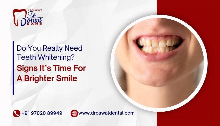 Eating with Braces: Friendly Foods for a Healthy Smile