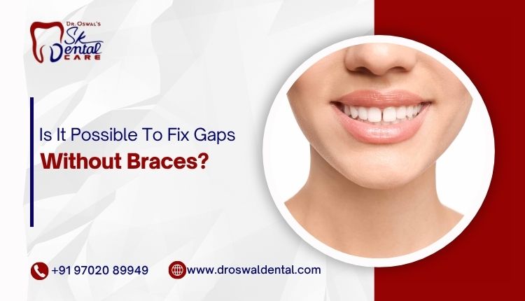 Eating with Braces: Friendly Foods for a Healthy Smile