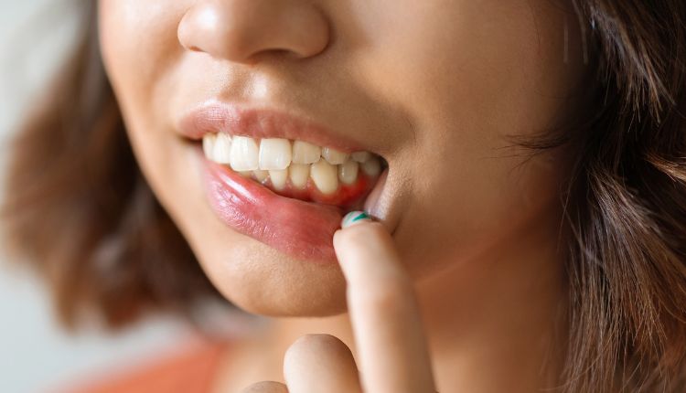 Eating with Braces: Friendly Foods for a Healthy Smile