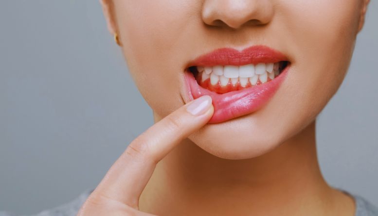 Eating with Braces: Friendly Foods for a Healthy Smile