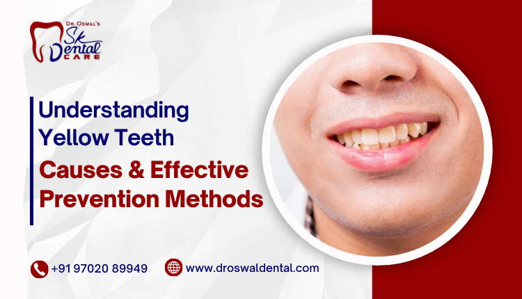 Understanding Yellow Teeth: Causes and Effective Prevention Methods